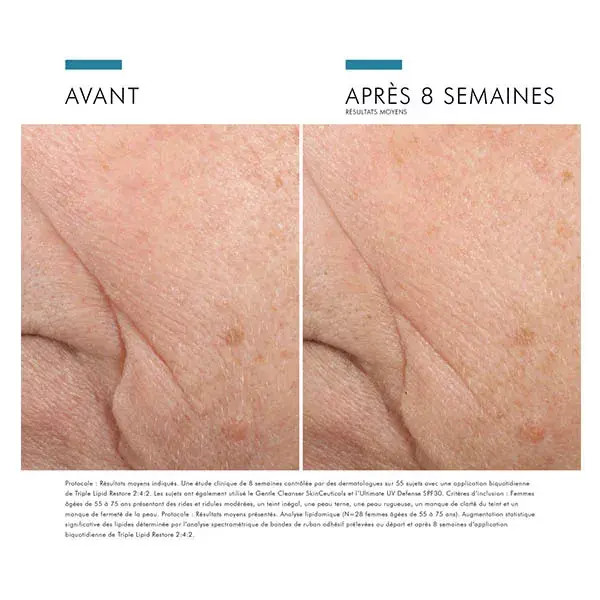 Skinceuticals Triple Lipid Restore 2:4:2 Lipid-Replenishing & Comfort Anti-Aging Facial Care 48ml