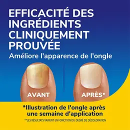 Dr. Scholl's Sérum Revitalisant Ongles Jaunis, Décolorés ou Abîmés Triple Action 10ml