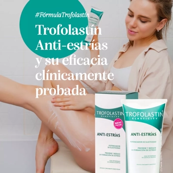 Trofolastin - Crema Antiestrías, Previene y Reduce la Formación de Estrías  - Embarazo, Adolescentes y deportistas - 250 ml (Paquete de 1)