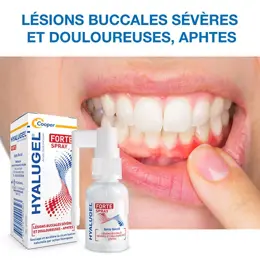 Hyalugel Gel Buccal Lésions Buccales Sévères et Douloureuses Tube 8ml