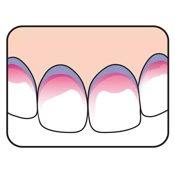 TePe PlaqSearch Dental Plaque Revealer 10 lozenges
