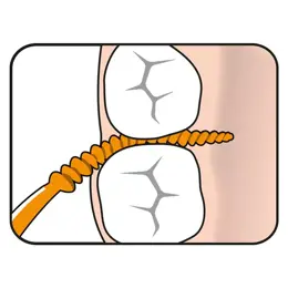 TePe Easy Pick Cure-Dents Silicone Orange XS/S 36 unités