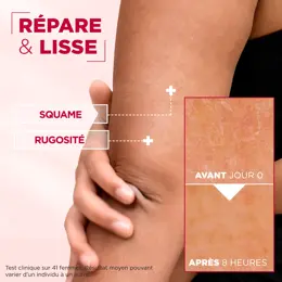 Mixa Crème Cica Reparation Peaux Très Sèches et Rugueuses Visage, Corps, Mains - 400ml