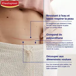 Elastoplast Traitements des Cicatrices Réducteur de Cicatrices 21 unités