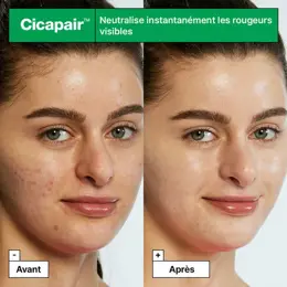 Dr Jart+ Cicapair™ Tiger Grass Traitement Correcteur de Couleur à L'Herbe du Tigre 15ml