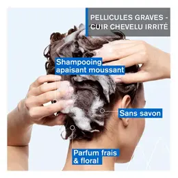 Uriage DS Hair Shampooing Traitant Kératoréducteur 150ml