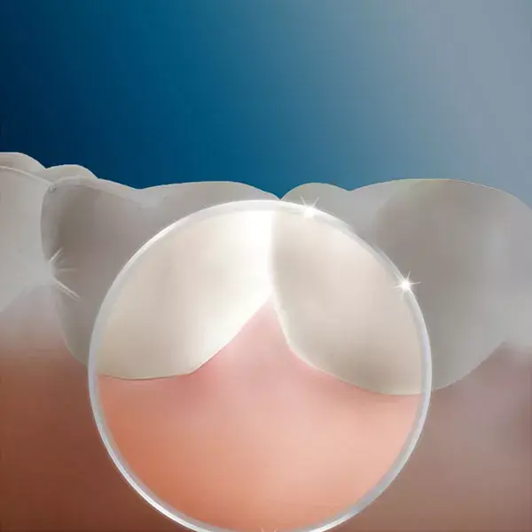 Oral B Oxyjet 4 Cánulas para Irrigador Dental