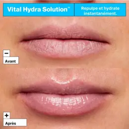 Dr Jart+ Vital Hydra Solution™ Masque Hydratant pour les Lèvres à l'Acide Hyaluronique 20ml