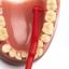 TePe Cepillo Interdental Ángulo 0,5mm 6 unidades