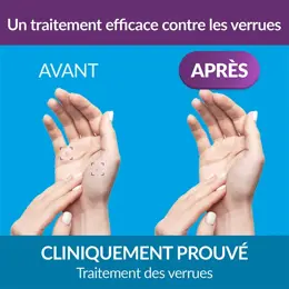 Excilor Verruxit Cryo Traitement des Verrues Mains et Pieds 50ml