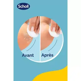 Scholl Rouleaux de Remplacement 2 en 1 Exfoliant & Lissant pour Râpe Electrique