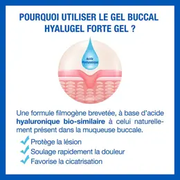 Hyalugel Forte Gel Buccal 8ml