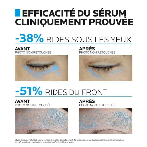 La Roche Posay Hyalu B5 Repairing Anti-Wrinkle Serum Set 50ml + Free Hyalu B5 Eye Serum 5ml