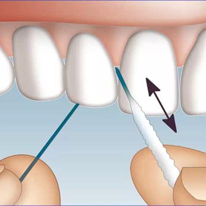Oral-B Seda Dental Super Floss 50 Hebras Precortadas