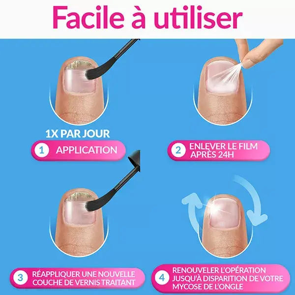 Excilor Forte Mycose de l'Ongle 30ml