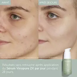 Caudalie Vinopure Sérum Salicylique Anti-Imperfections 30ml