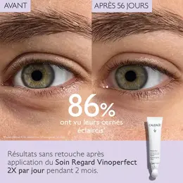 Caudalie Vinoperfect Soin Éclaircissant Regard 15ml