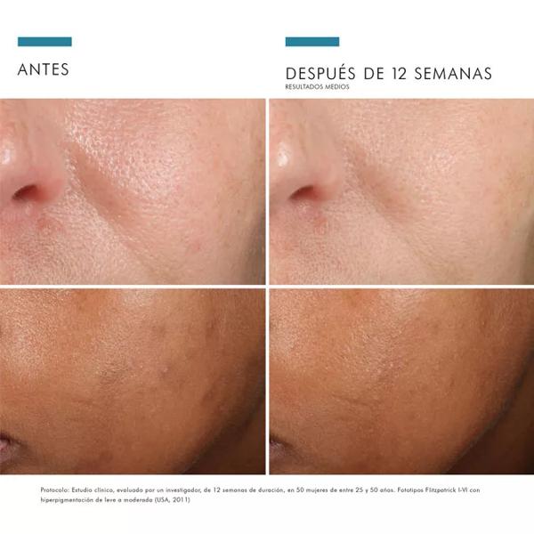 SkinCeuticals Prevent Phloretin CF Anti-Aging Serum 30 ml