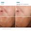 SkinCeuticals Prevent Phloretin CF Anti-Aging Serum 30 ml