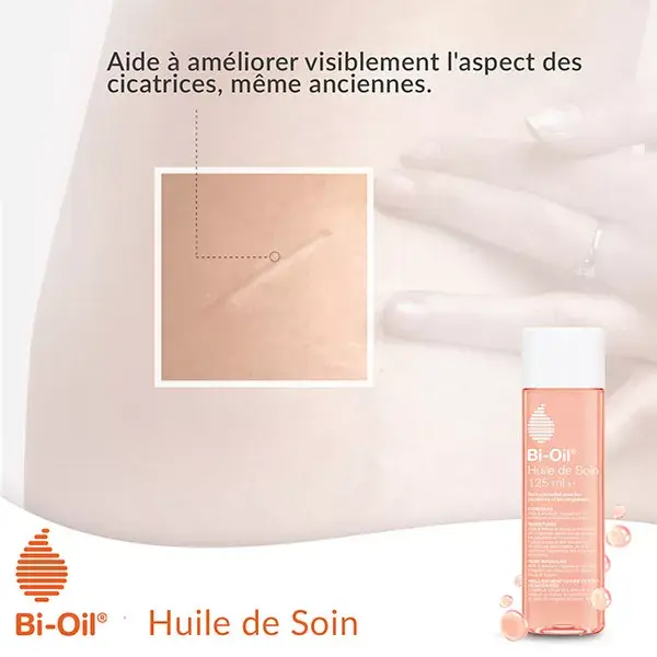 Bi-Oil Moisturizing Skin Care Oil for Scars & Stretch Marks 125ml