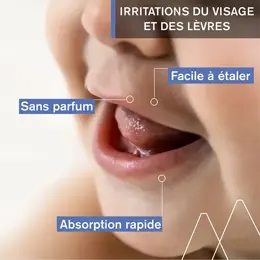 Uriage Bébé 1er Soin Peri-Oral Apaisant Anti-Irritations 30ml