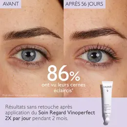 Caudalie Vinoperfect Soin Éclaircissant Regard 15ml