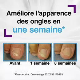 Emtrix® Traitement pour Mycoses ou Psoriasis des Ongles 10 ml