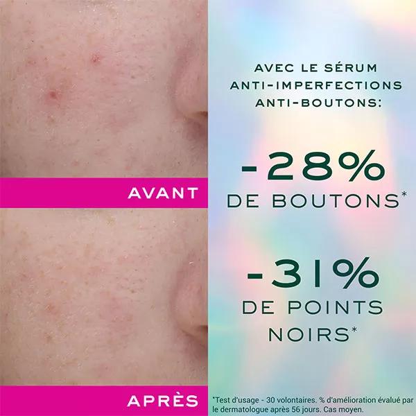 Nuxe Zinc Power Sérum Antiimperfecciones Antiimperfecciones 30ml
