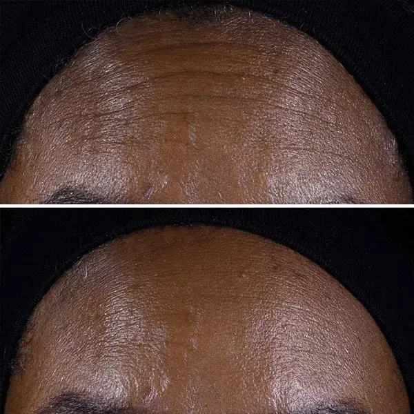 Clinique Smart Clinical Repair™ mart Clinical Repair Lifting Face + Neck Cream 50ml