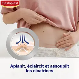 Elastoplast Traitements des Cicatrices Réducteur de Cicatrices 21 unités