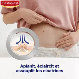 Elastoplast Traitements des Cicatrices Réducteur de Cicatrices XL 21 unités